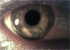 My eyeball, circa August, 2000.